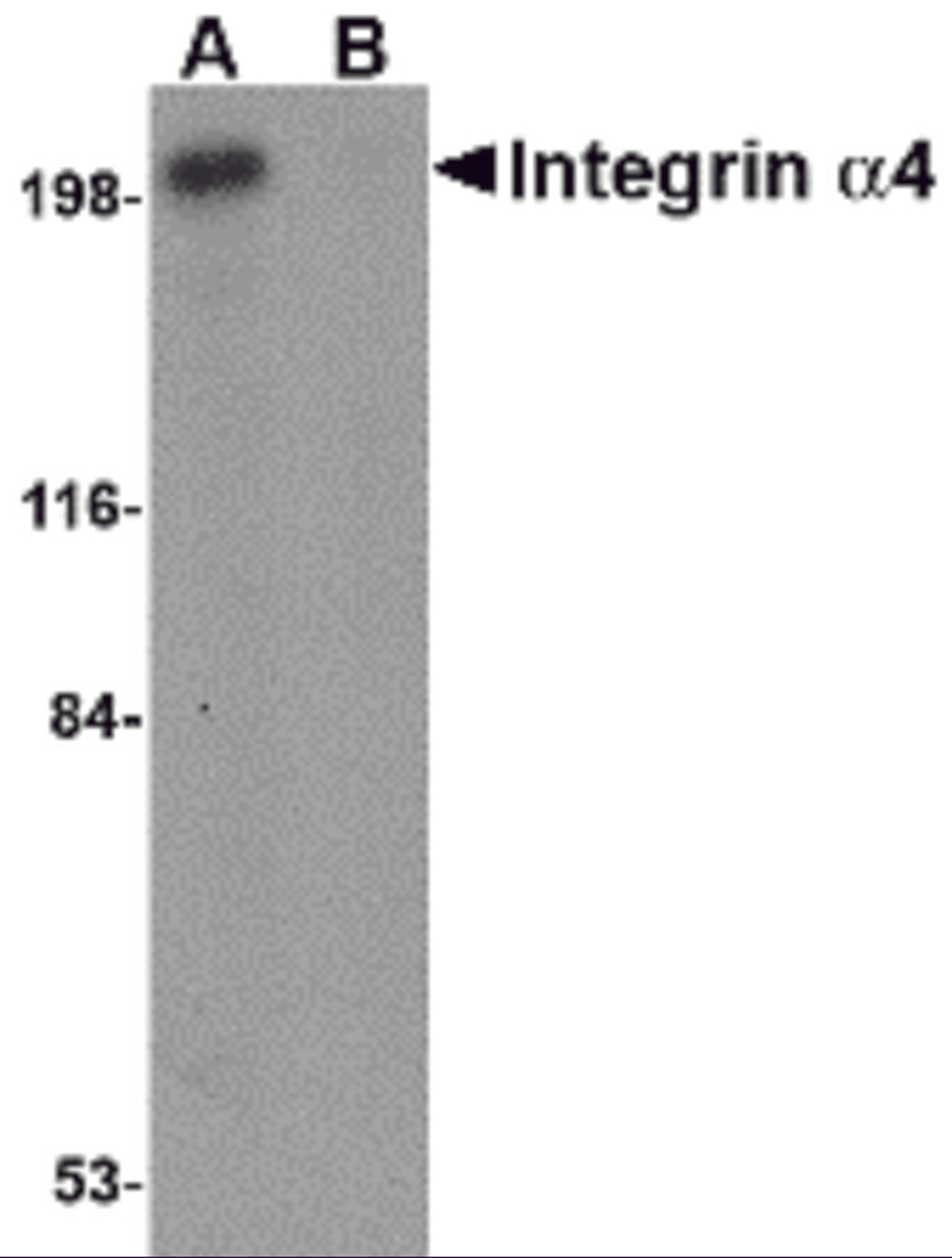 Western blot analysis of Integrin alpha 4 in Jurkat cell lysate with Integrin alpha 4 antibody at 1 μg/mL in (A) the absence and (B) the presence of blocking peptide.
