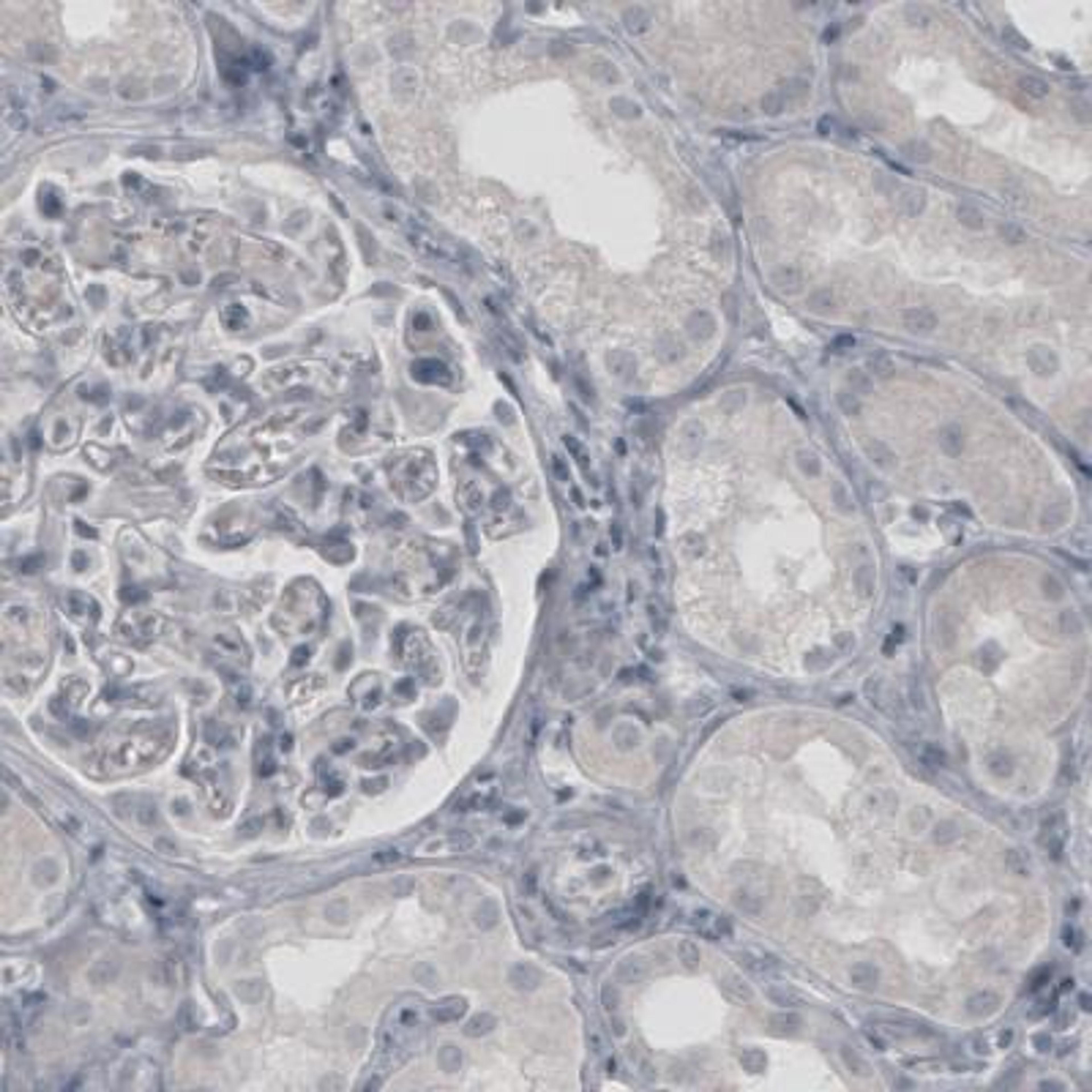 Immunohistochemistry-Paraffin: VGLUT2 Antibody (2952) [NBP2-46641] - Analysis of human kidney shows absence of immunoreactivity (negative control).