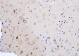 Immunohistochemical analysis of formalin-fixed paraffin embedded mouse embryo tissue using Vitamin D Receptor antibody (dilution at 1:200)