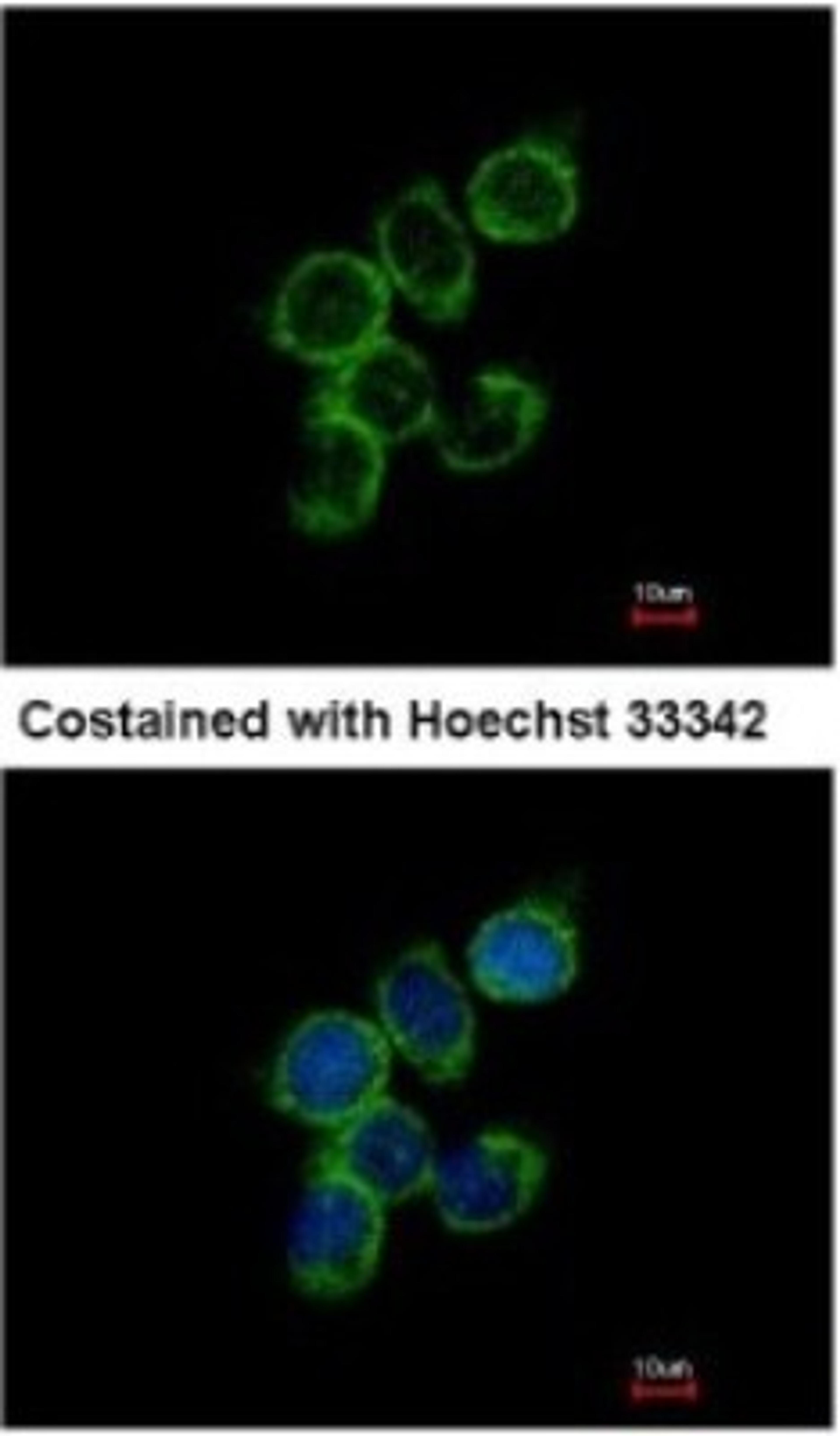 Immunocytochemistry/Immunofluorescence: GAS2L1 Antibody [NBP1-32310] - Analysis of methanol-fixed A431, using antibody at 1:500 dilution.