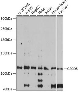 Western blot - C2CD5 antibody (A14357)