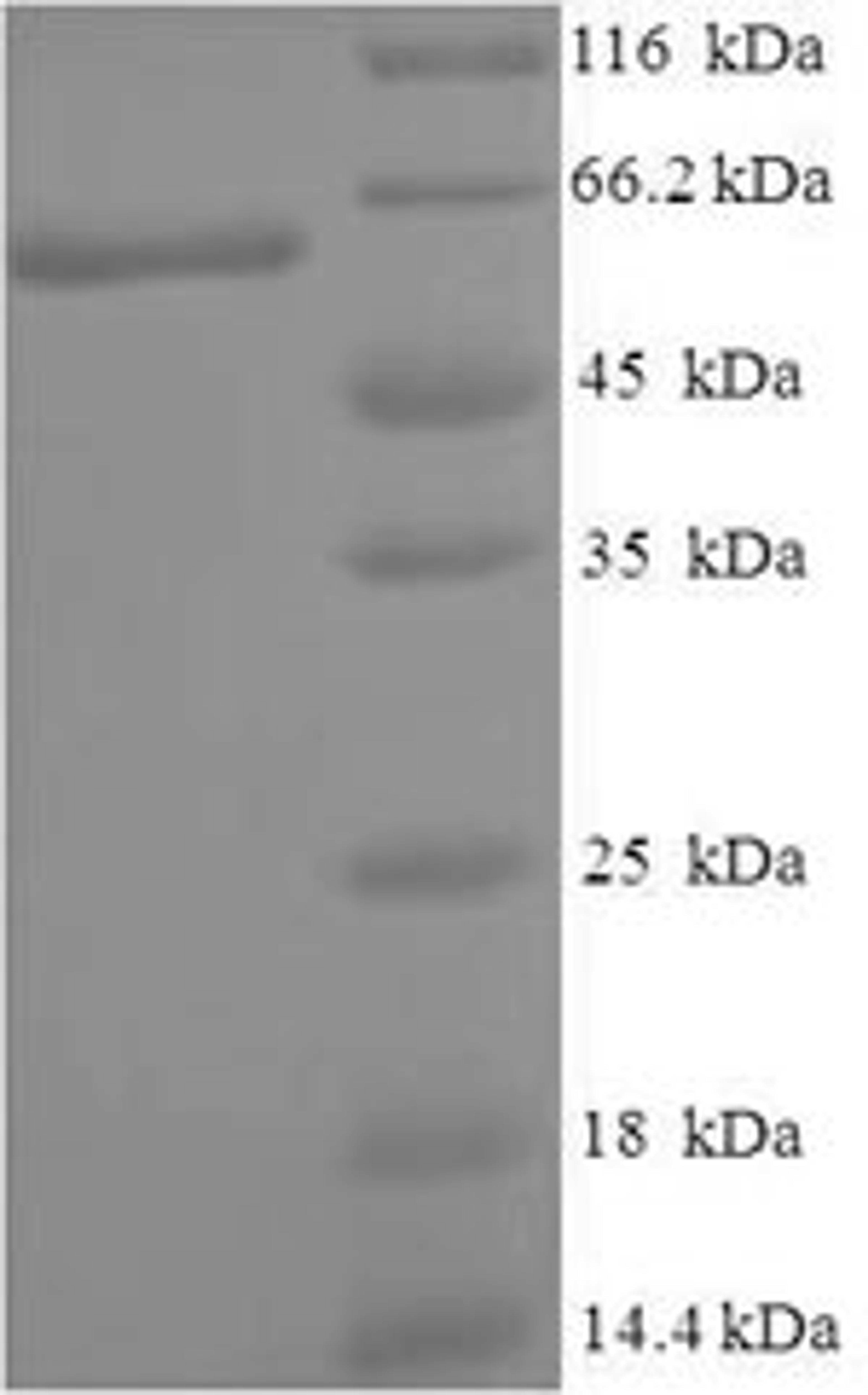 (Tris-Glycine gel) Discontinuous SDS-PAGE (reduced) with 5% enrichment gel and 15% separation gel.