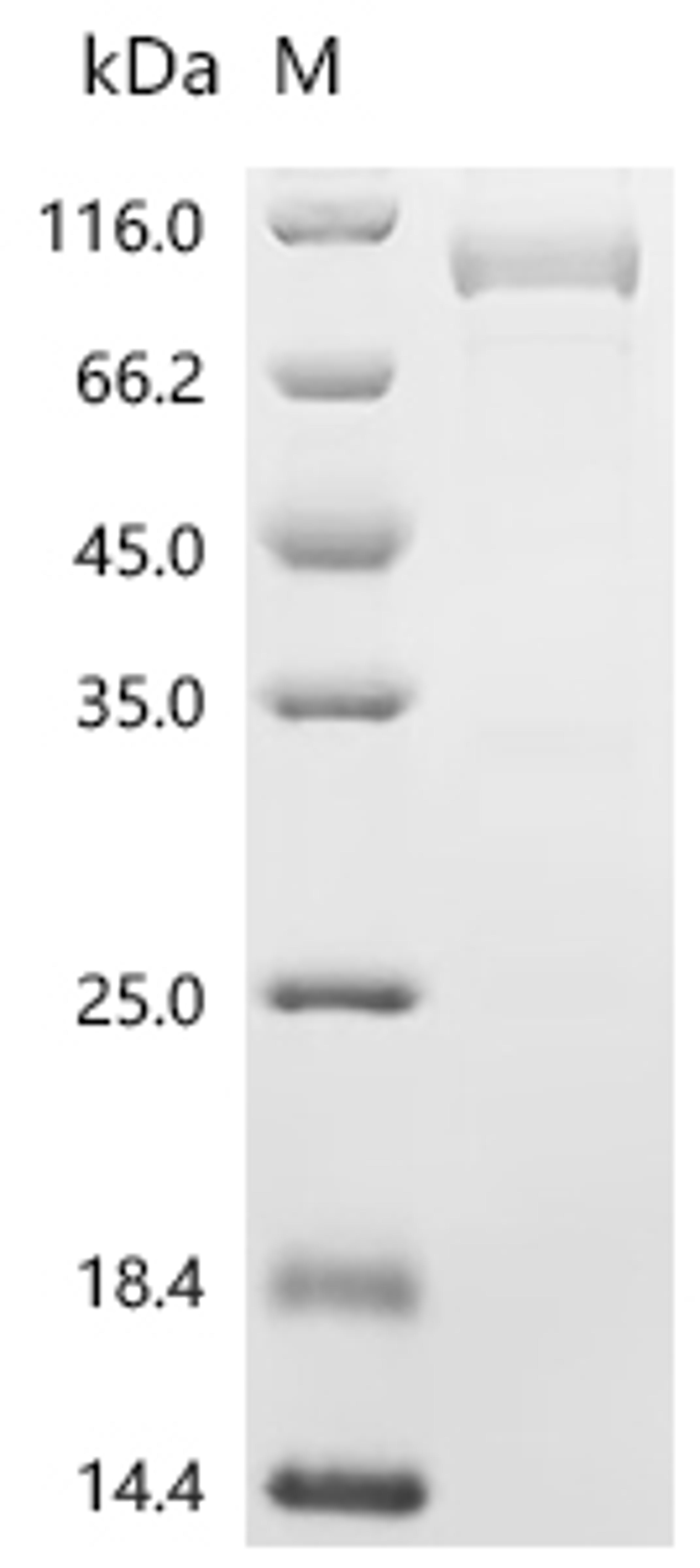 (Tris-Glycine gel) Discontinuous SDS-PAGE (reduced) with 5% enrichment gel and 15% separation gel.