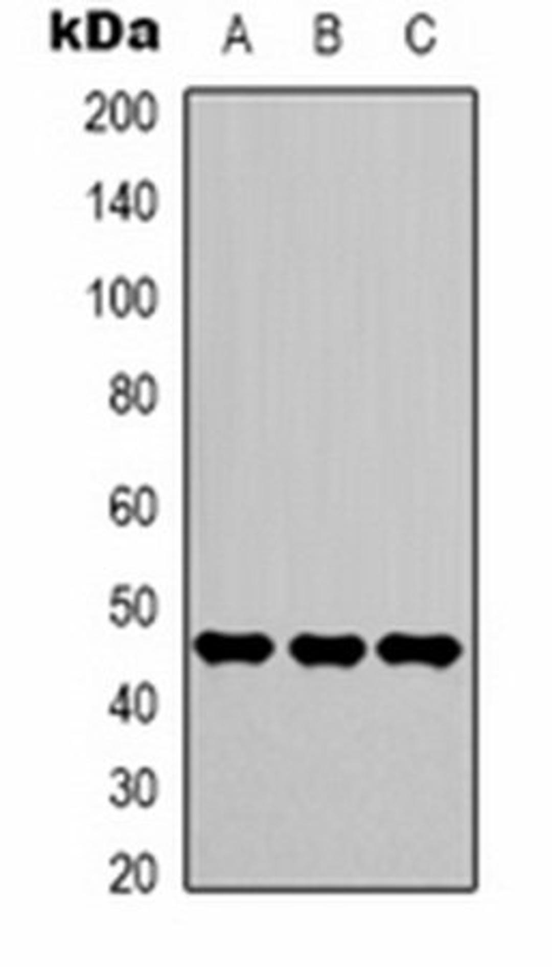 Western blot analysis of Hela (Lane 1), Jurkat (Lane 2), 293T (Lane 3) whole cell lysates using Gamma-enolase antibody