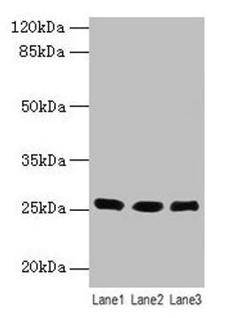 Western blot. All lanes: LIN7A antibody at 6µg/ml. Lane 1: Human placenta tissue. Lane 2: Mouse kidney tissue. Lane 3: Mouse liver tissue. Secondary. Goat polyclonal to rabbit IgG at 1/10000 dilution. Predicted band size: 26 kDa. Observed band size: 26 kDa