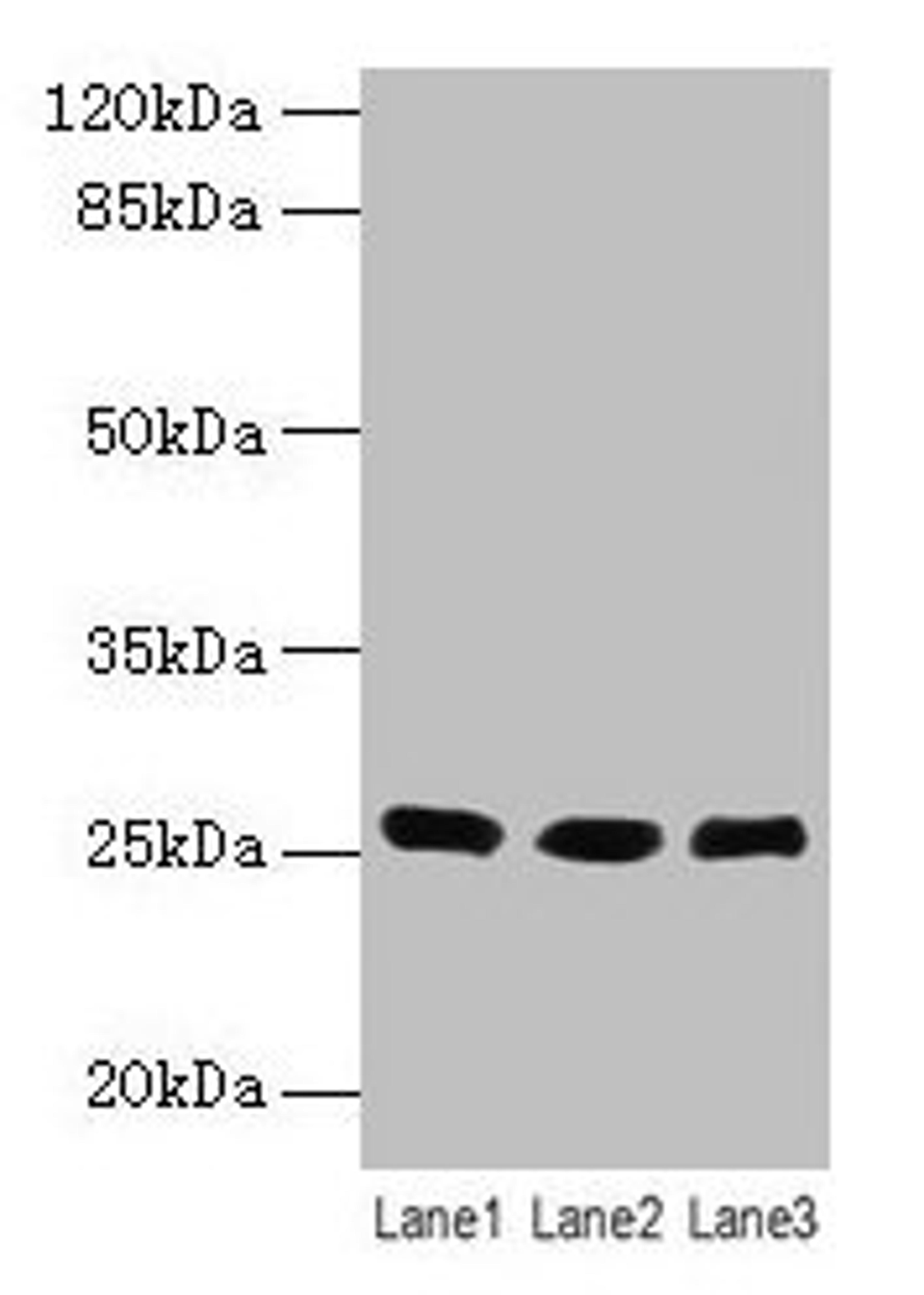 Western blot. All lanes: LIN7A antibody at 6µg/ml. Lane 1: Human placenta tissue. Lane 2: Mouse kidney tissue. Lane 3: Mouse liver tissue. Secondary. Goat polyclonal to rabbit IgG at 1/10000 dilution. Predicted band size: 26 kDa. Observed band size: 26 kDa