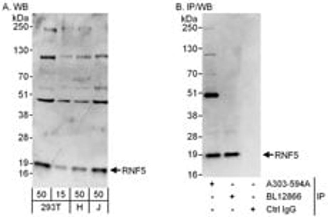 Detection of human RNF5 by western blot and immunoprecipitation.