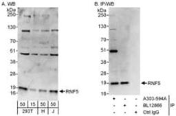 Detection of human RNF5 by western blot and immunoprecipitation.