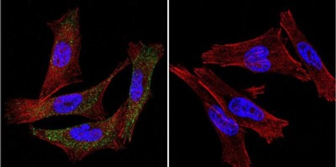 Immunocytochemistry/Immunofluorescence: P-Cadherin Antibody (6A9) [NB100-74489] - Cadherin P (green), F-Actin staining with Phalloidin (red) and nuclei with DAPI (blue) is shown. Cells were grown on chamber slides and fixed with formaldehyde prior to staining. Cells were probed without (control) or with an antibody recognizing Cadherin P at a dilution of 1:20 over night at 4C, washed with PBS and incubated with a DyLight-488 conjugated.