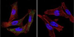 Immunocytochemistry/Immunofluorescence: P-Cadherin Antibody (6A9) [NB100-74489] - Cadherin P (green), F-Actin staining with Phalloidin (red) and nuclei with DAPI (blue) is shown. Cells were grown on chamber slides and fixed with formaldehyde prior to staining. Cells were probed without (control) or with an antibody recognizing Cadherin P at a dilution of 1:20 over night at 4C, washed with PBS and incubated with a DyLight-488 conjugated.