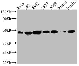 Western Blot. Positive WB detected in: Hela whole cell lysate, 293 whole cell lysate, K562 whole cell lysate, 293T whole cell lysate, A549 whole cell lysate, Rat Brain whole cell lysate, Mouse Brain whole cell lysate. All lanes: NUDC antibody at 1:1000. Secondary. Goat polyclonal to rabbit IgG at 1/50000 dilution. Predicted band size: 39 kDa. Observed band size: 45 kDa. 