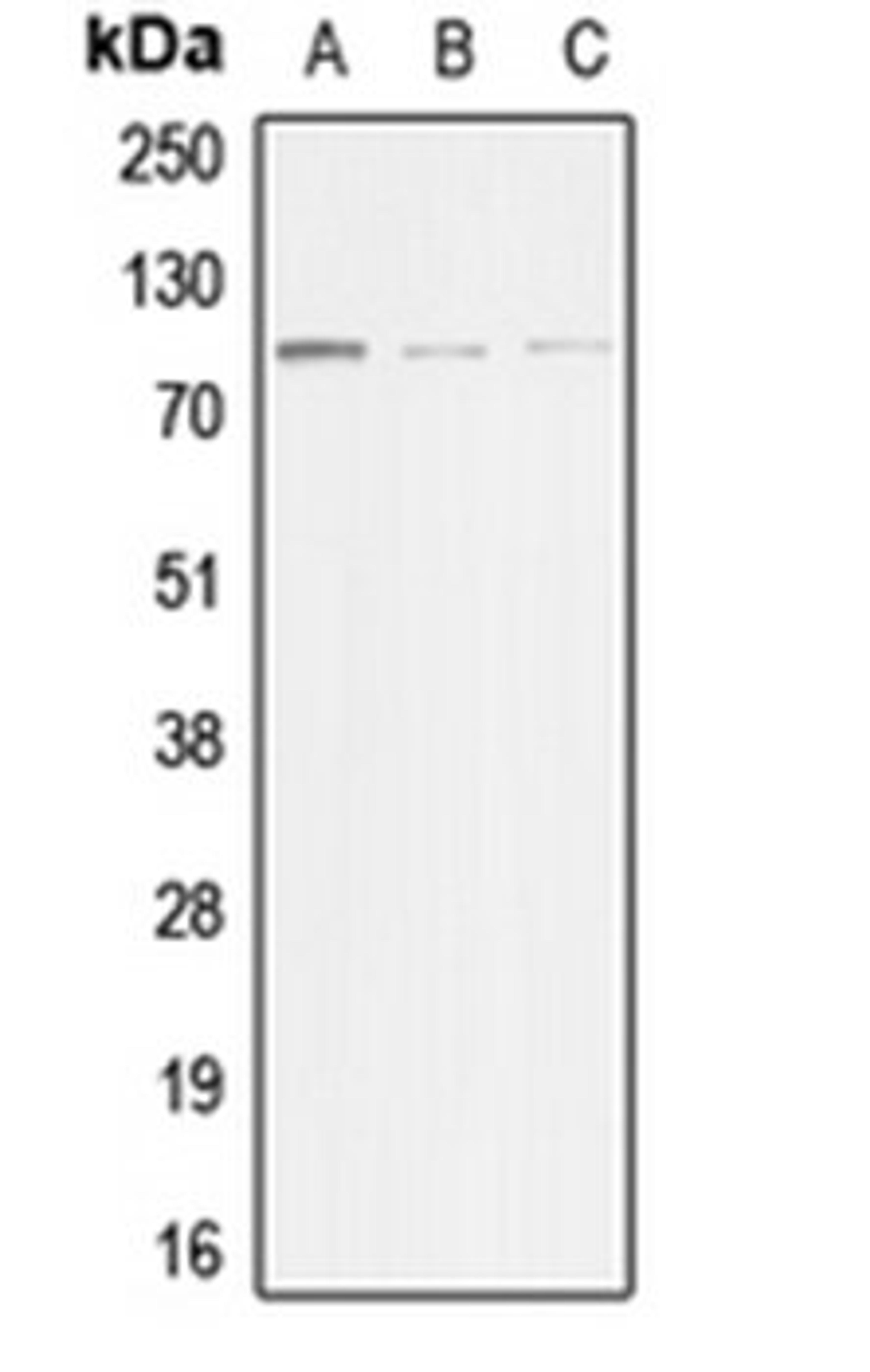 Western blot analysis of HeLa (Lane 1), mouse muscle (Lane 2), rat muscle (Lane 3) whole cell lysates using ACTN3 antibody