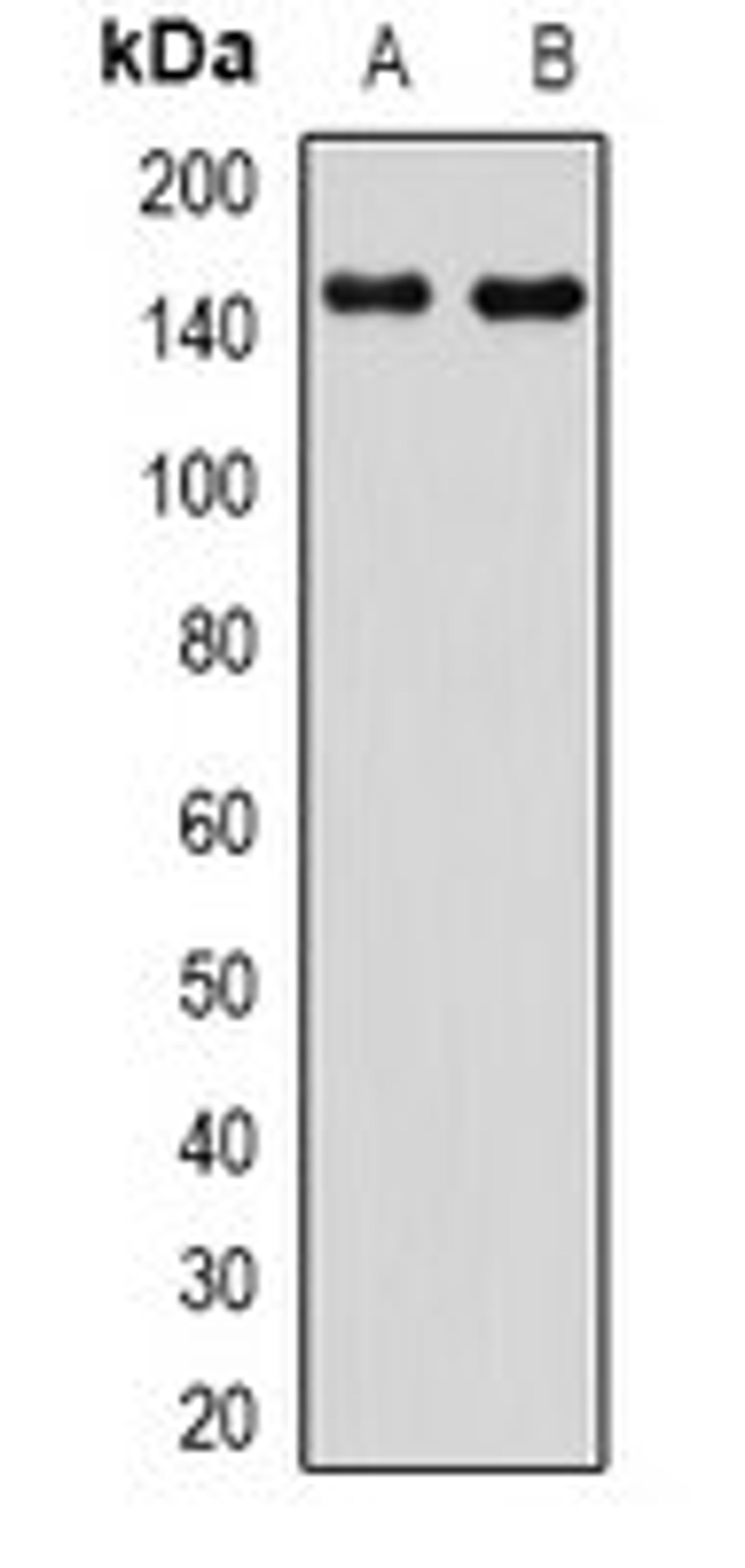 Western blot analysis of HepG2 (Lane1), Hela (Lane2) whole cell lysates using CYFIP2 antibody