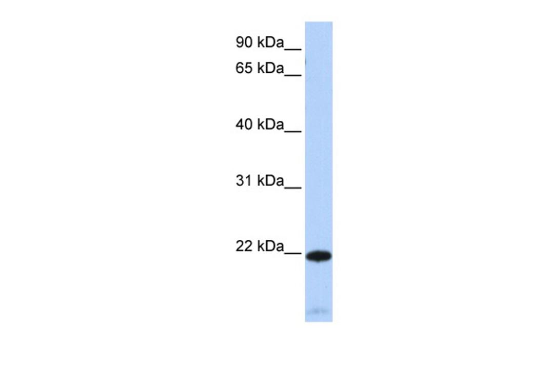 Antibody used in WB on Human Heart at 0.2-1 ug/ml.