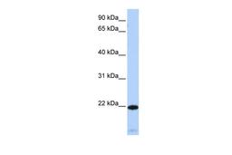 Antibody used in WB on Human Heart at 0.2-1 ug/ml.