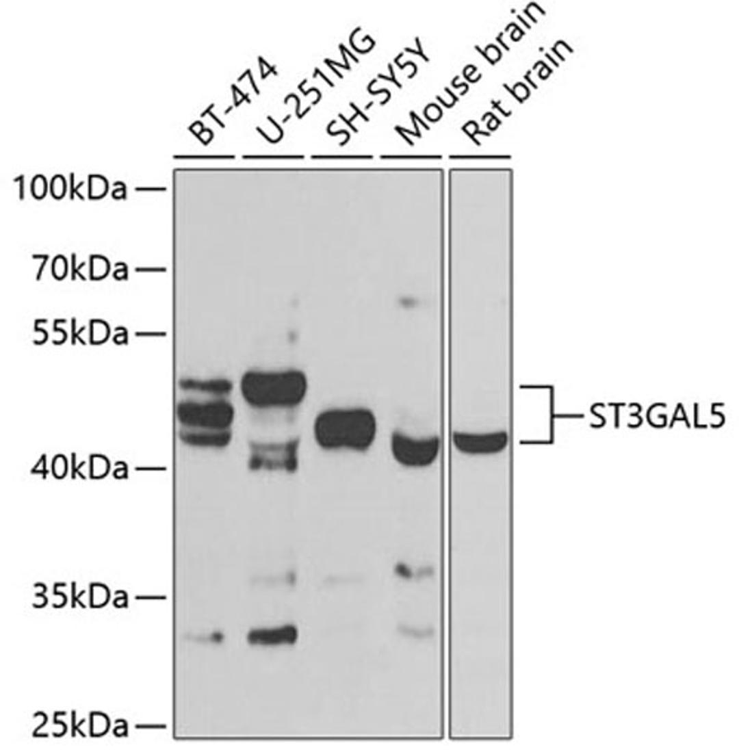 Western blot - ST3GAL5 antibody (A7947)