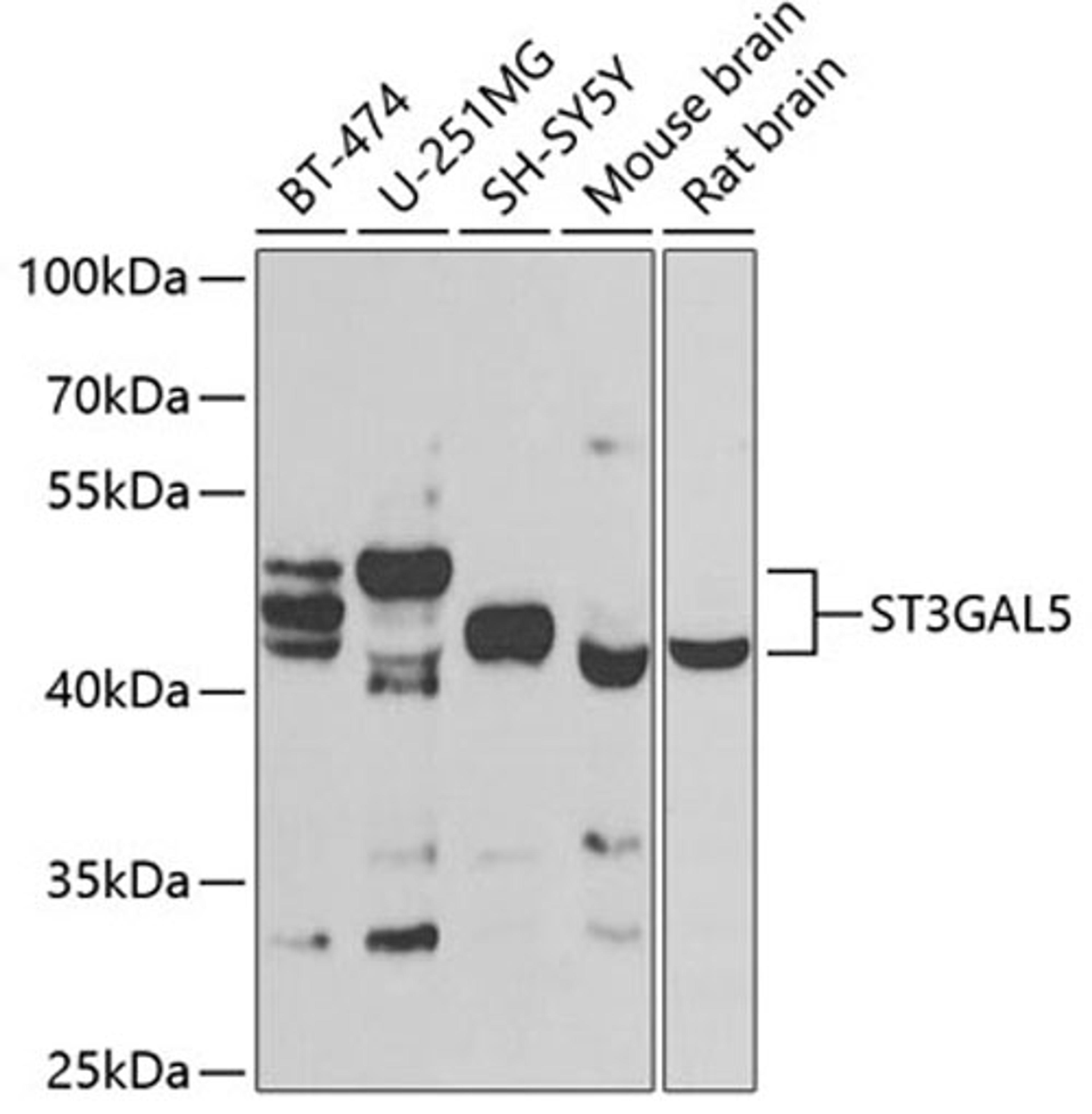 Western blot - ST3GAL5 antibody (A7947)