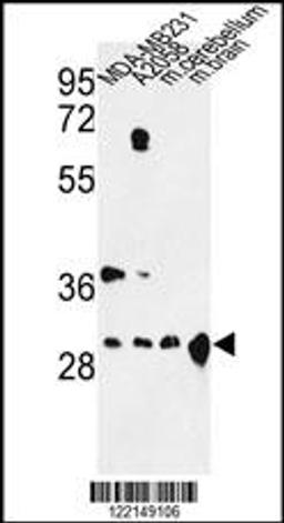 Western blot analysis of YWHAZ Antibody in MDA-MB231, A2058 cell line and mouse cerebellum, brain tissue lysates (35ug/lane)