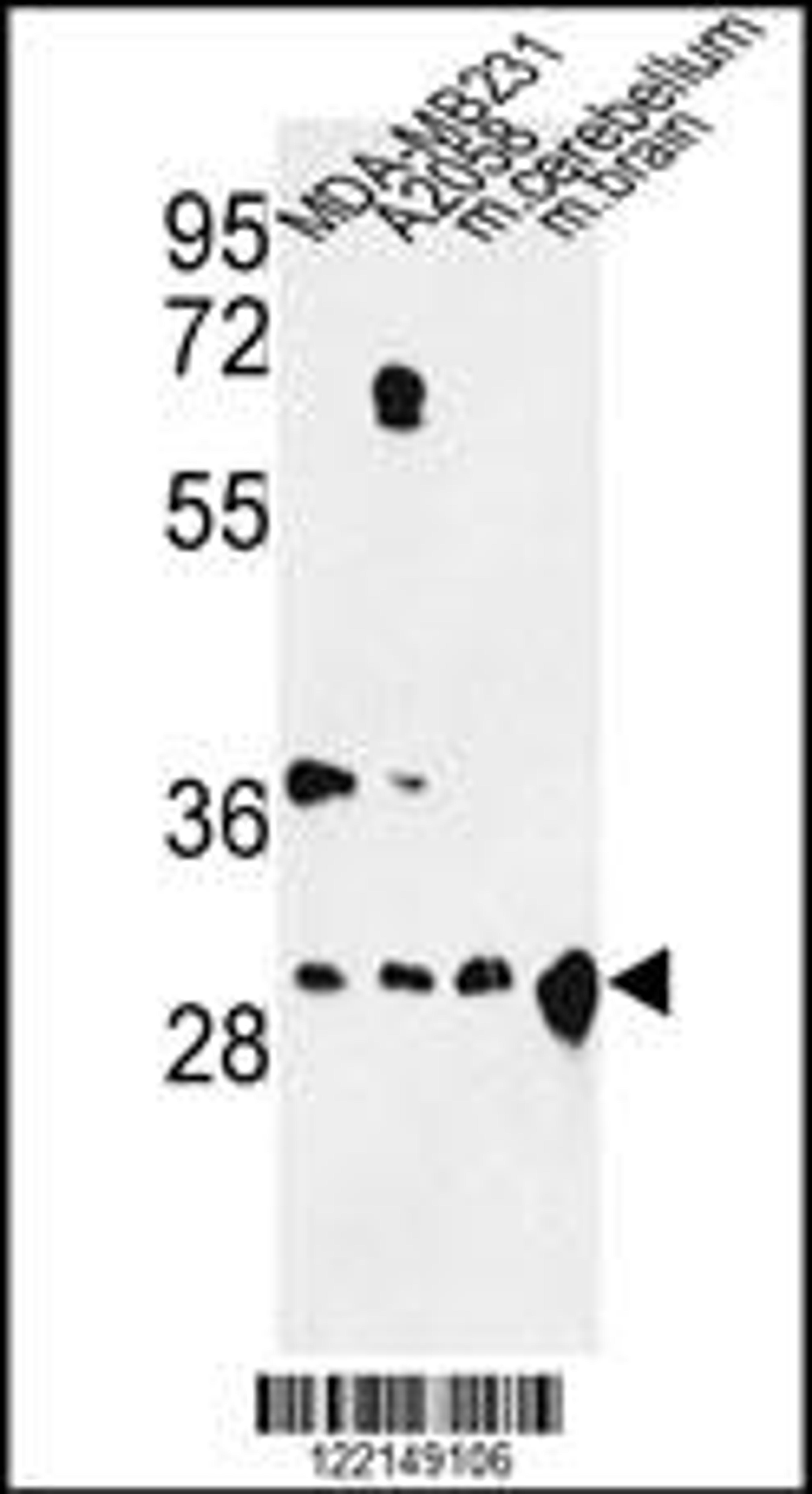 Western blot analysis of YWHAZ Antibody in MDA-MB231, A2058 cell line and mouse cerebellum, brain tissue lysates (35ug/lane)