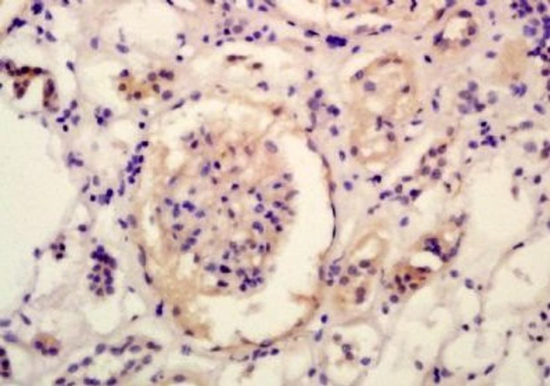 Immunohistochemical analysis of formalin-fixed paraffin embedded human kidney tissue using SLC6A19 antibody (dilution at 1:200)