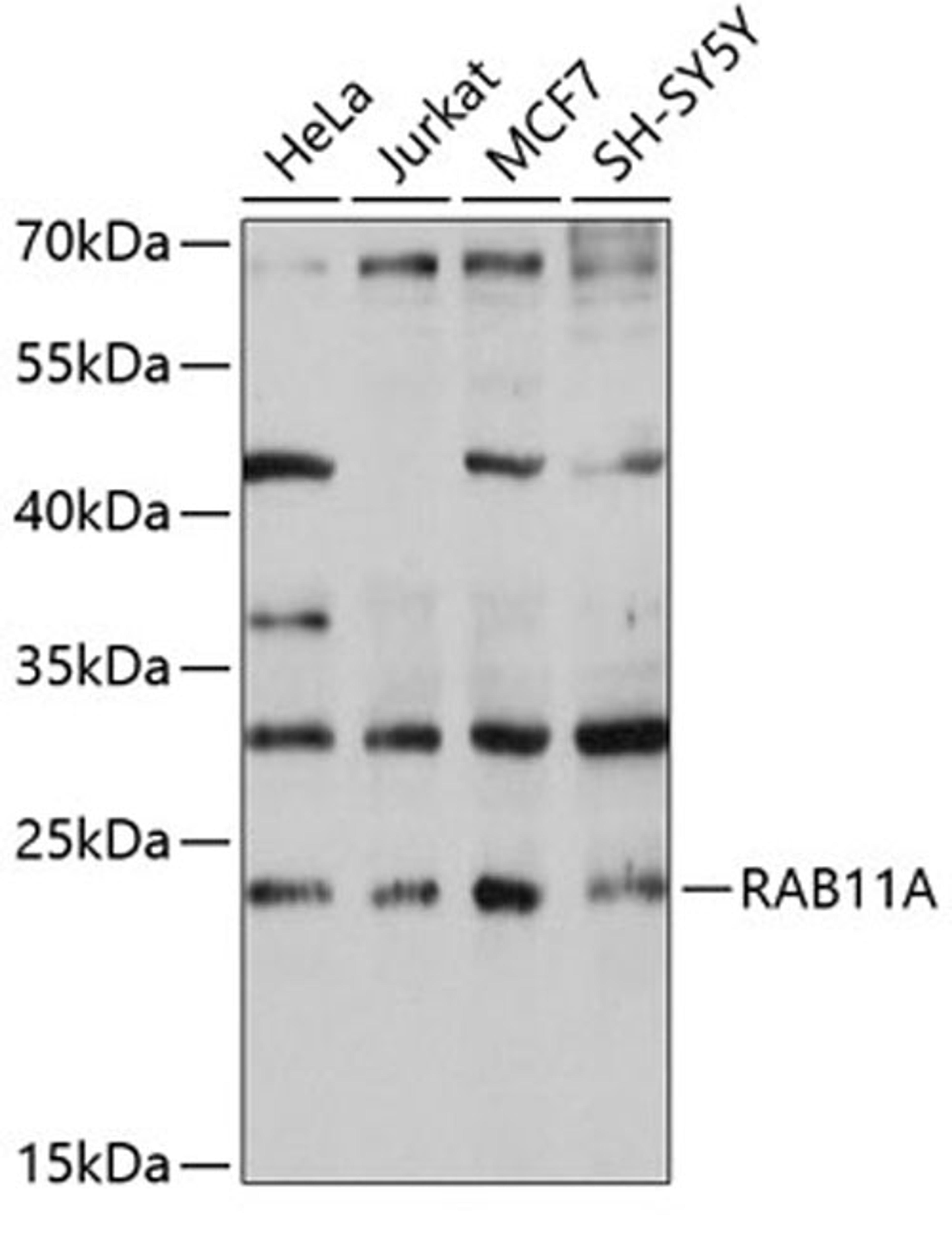 Western blot - RAB11A antibody (A1167)