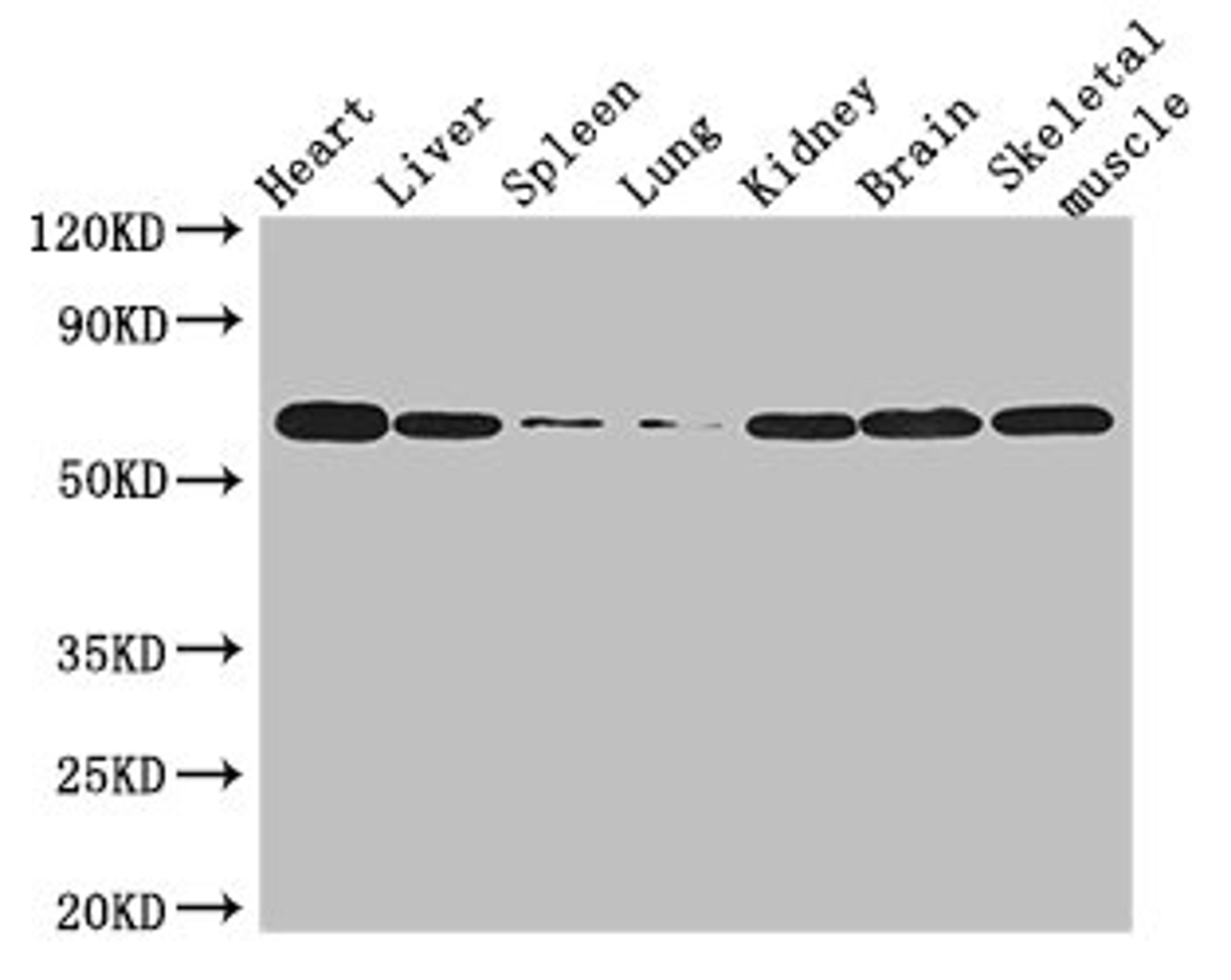 Western Blot. Positive WB detected in: Mouse heart tissue, Mouse liver tissue, Mouse spleen tissue, Mouse lung tissue, Mouse kidney tissue, Mouse brain tissue, Mouse skeletal muscle tissue. All lanes: TBX21 antibody at 3µg/ml. Secondary. Goat polyclonal to rabbit IgG at 1/50000 dilution. Predicted band size: 59 kDa. Observed band size: 59 kDa
