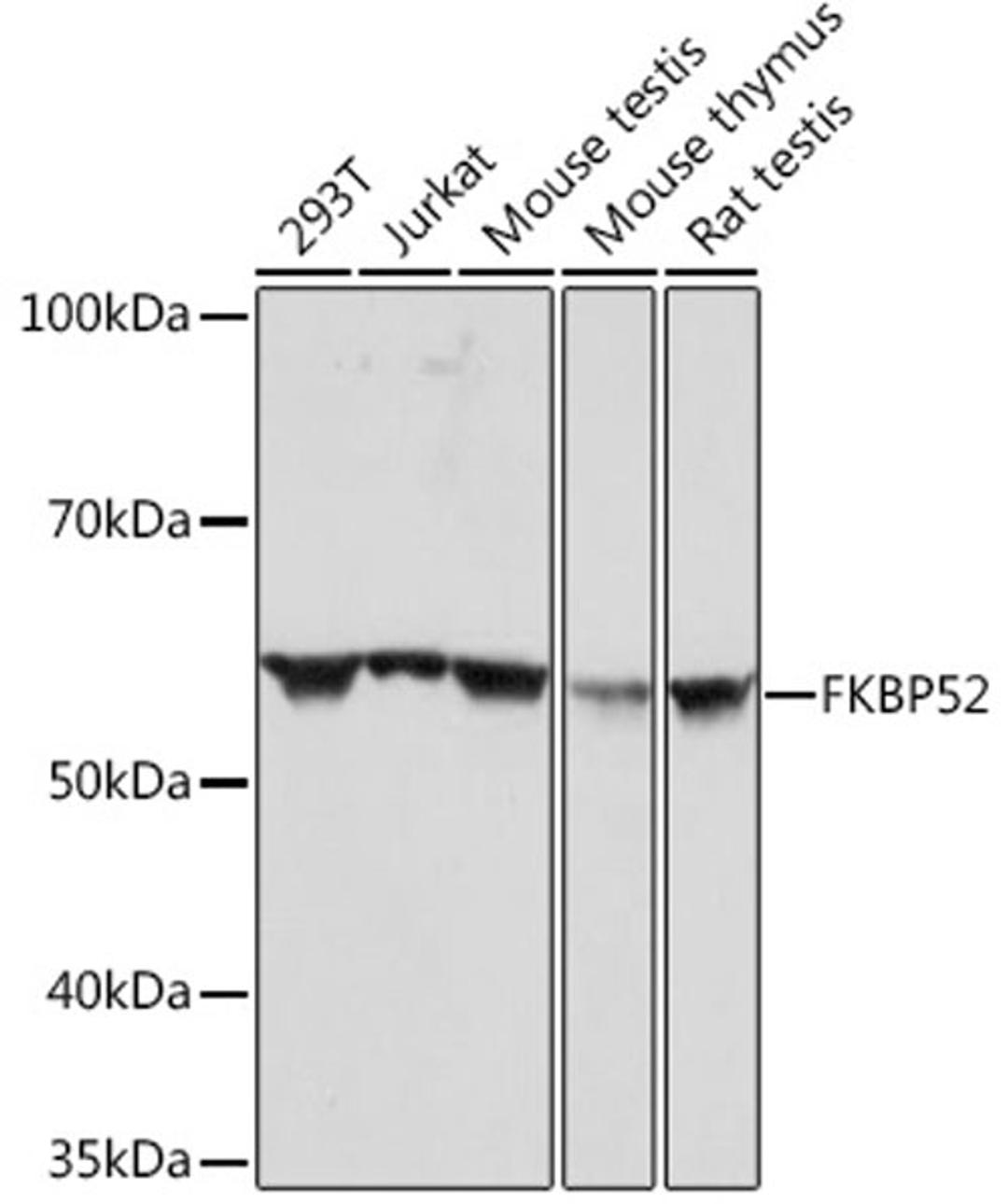 Western blot - FKBP52 Rabbit mAb (A4356)