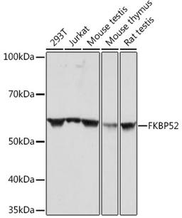 Western blot - FKBP52 Rabbit mAb (A4356)