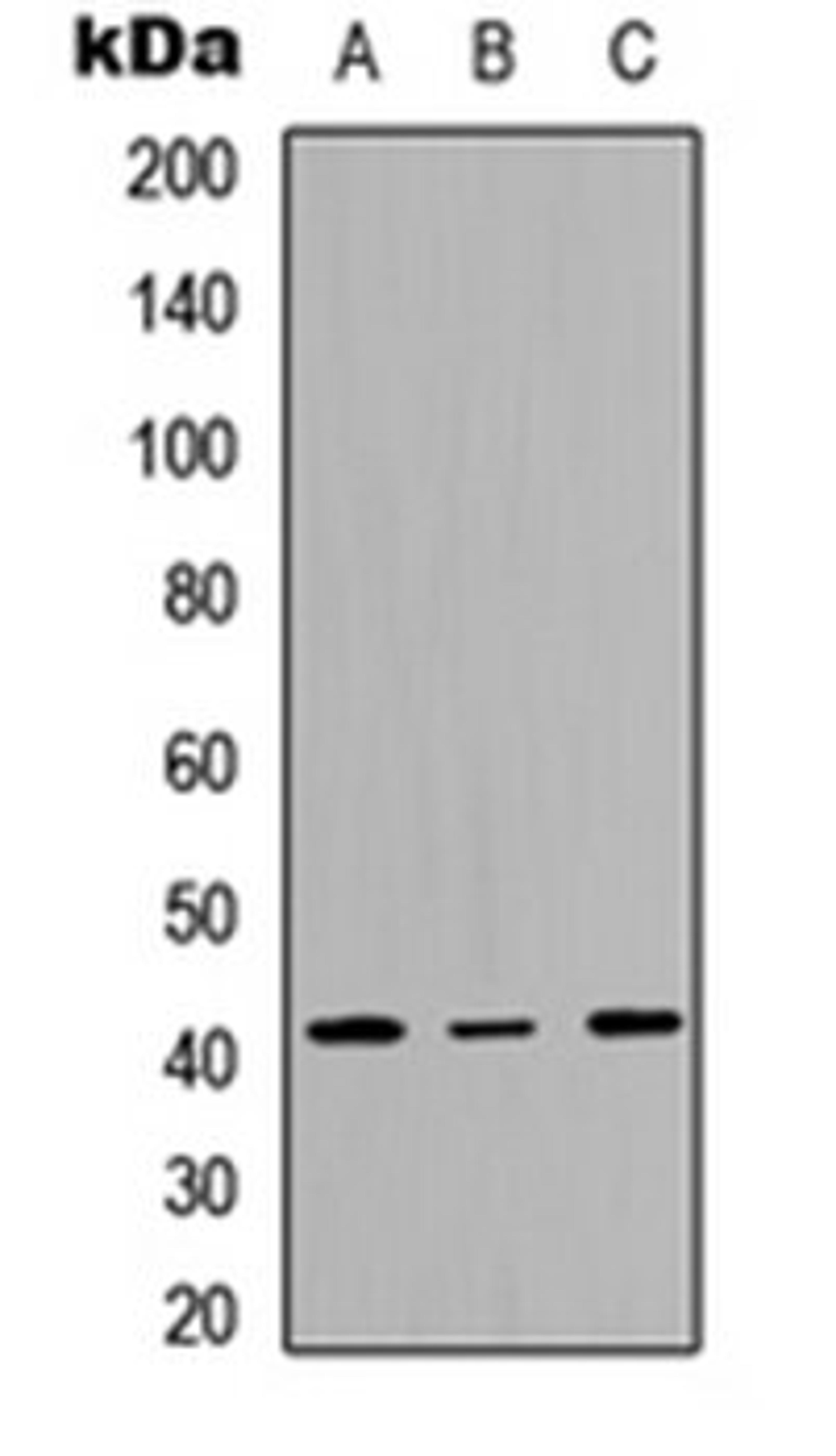 Western blot analysis of A549 (Lane 1), NS-1 (Lane 2), H9C2 (Lane 3) whole cell lysates using SAPK4 antibody