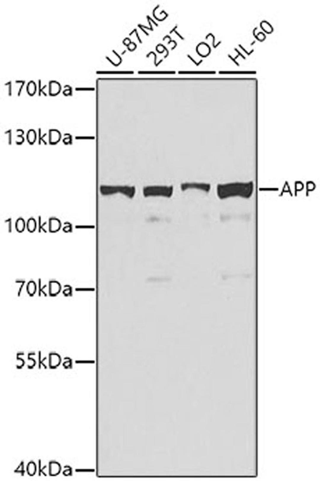 Western blot - APP antibody (A0206)