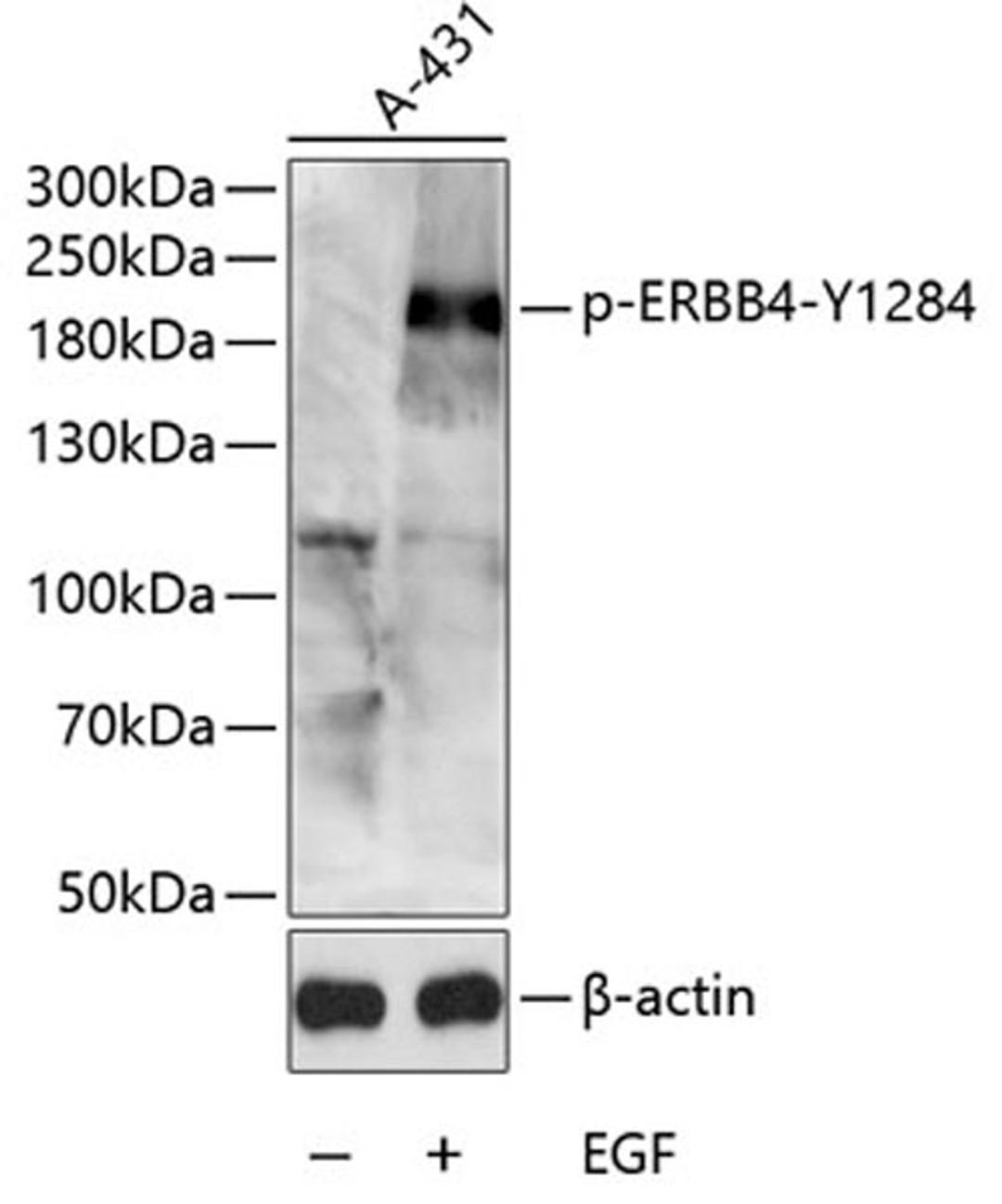 Western blot - Phospho-ERBB4-Y1284 antibody (AP0034)