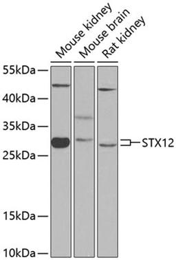 Western blot - STX12 antibody (A8200)