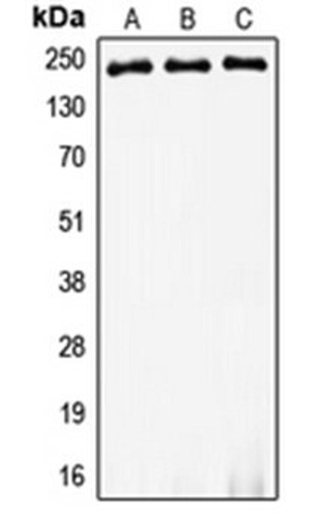 Western blot analysis of HeLa (Lane 1), SP2/0 (Lane 2), PC12 (Lane 3) whole cell lysates using MYH8 antibody