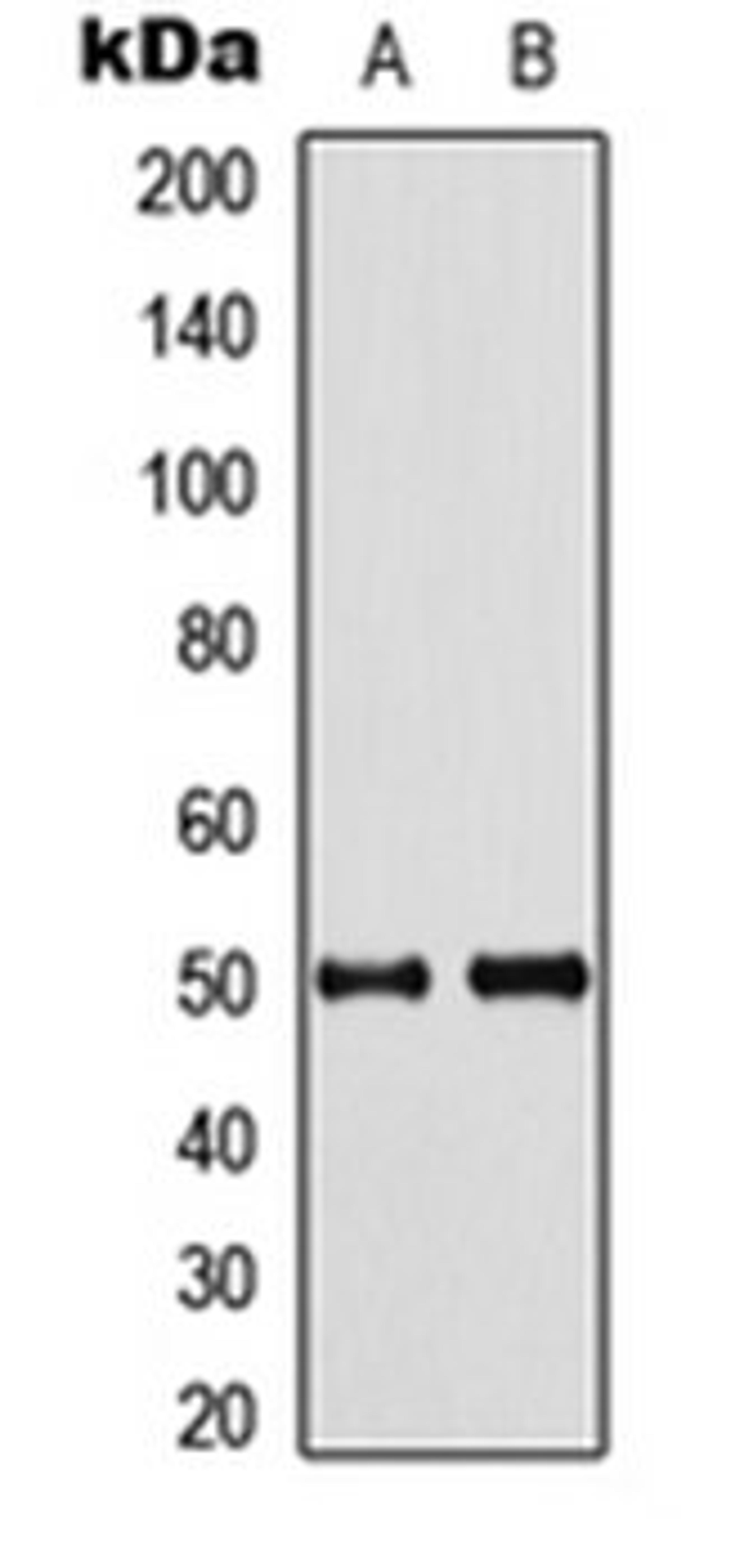 Western blot analysis of HeLa (Lane 1), mouse brain (Lane 2) whole cell lysates using Septin 8 antibody