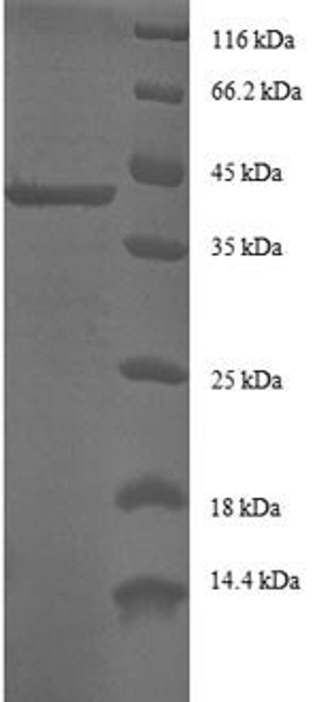 (Tris-Glycine gel) Discontinuous SDS-PAGE (reduced) with 5% enrichment gel and 15% separation gel.