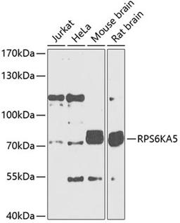 Western blot - RPS6KA5 Antibody (A5699)