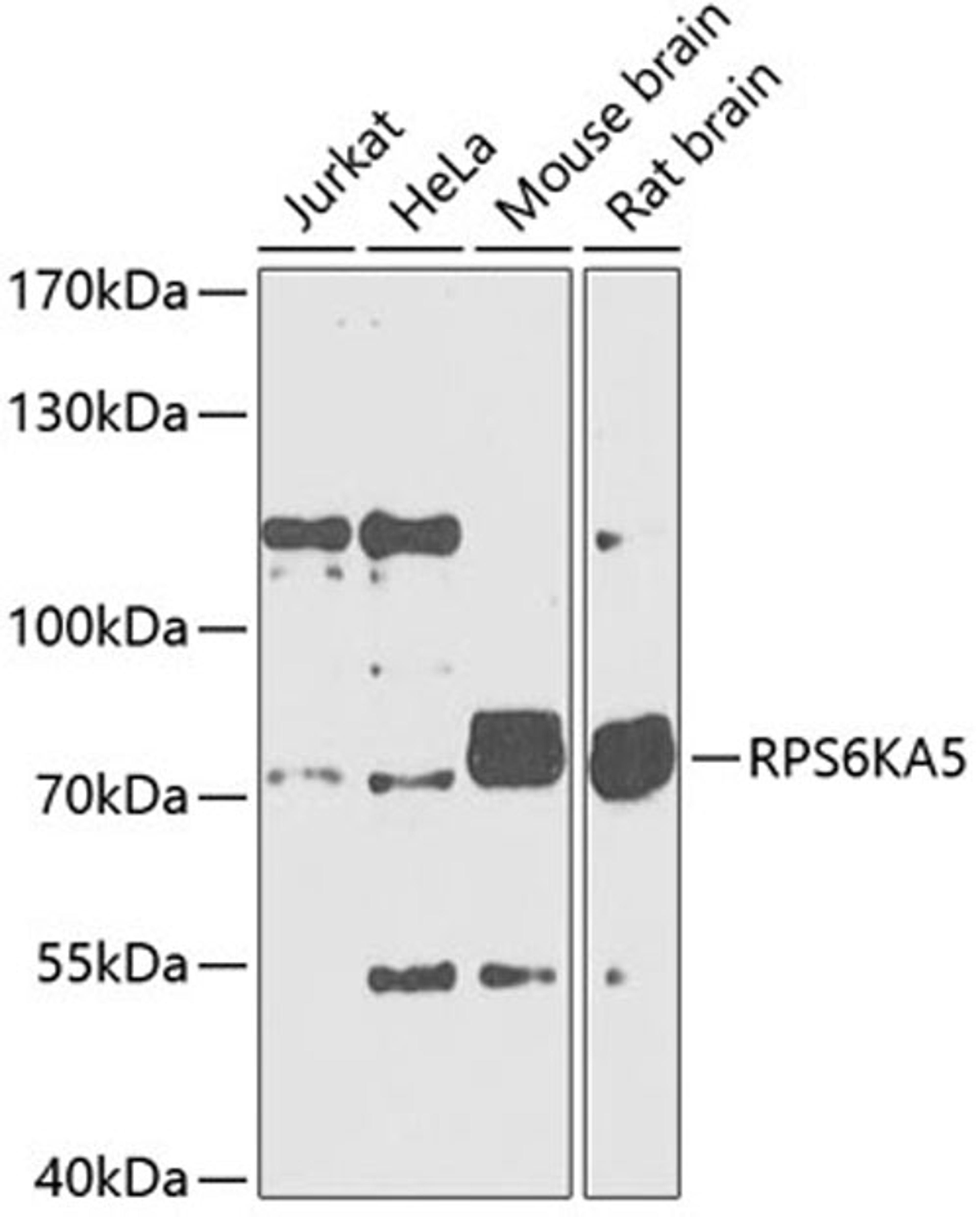 Western blot - RPS6KA5 Antibody (A5699)