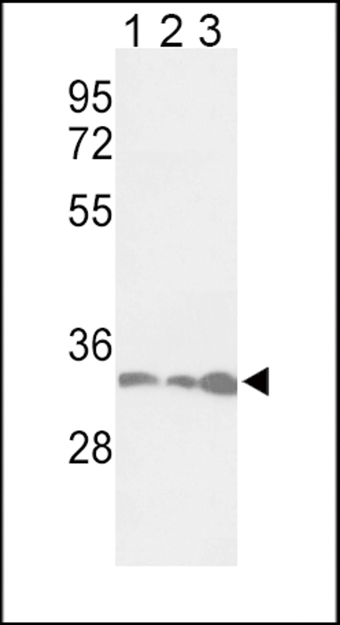 Western blot analysis of PCNA Antibody in Jurkat(lane 1), Hela(lane 2), 293(lane 3) cell line lysates (35ug/lane)