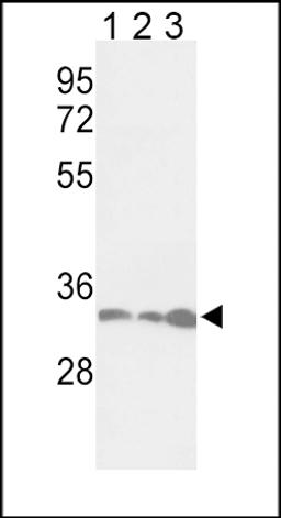 Western blot analysis of PCNA Antibody in Jurkat(lane 1), Hela(lane 2), 293(lane 3) cell line lysates (35ug/lane)