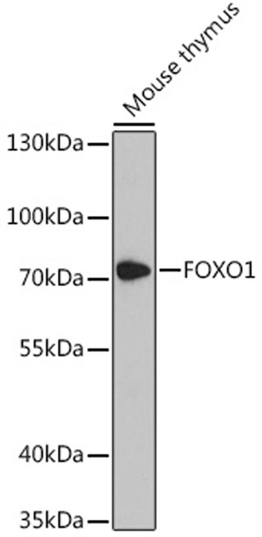 Western blot - FOXO1 antibody (A13862)