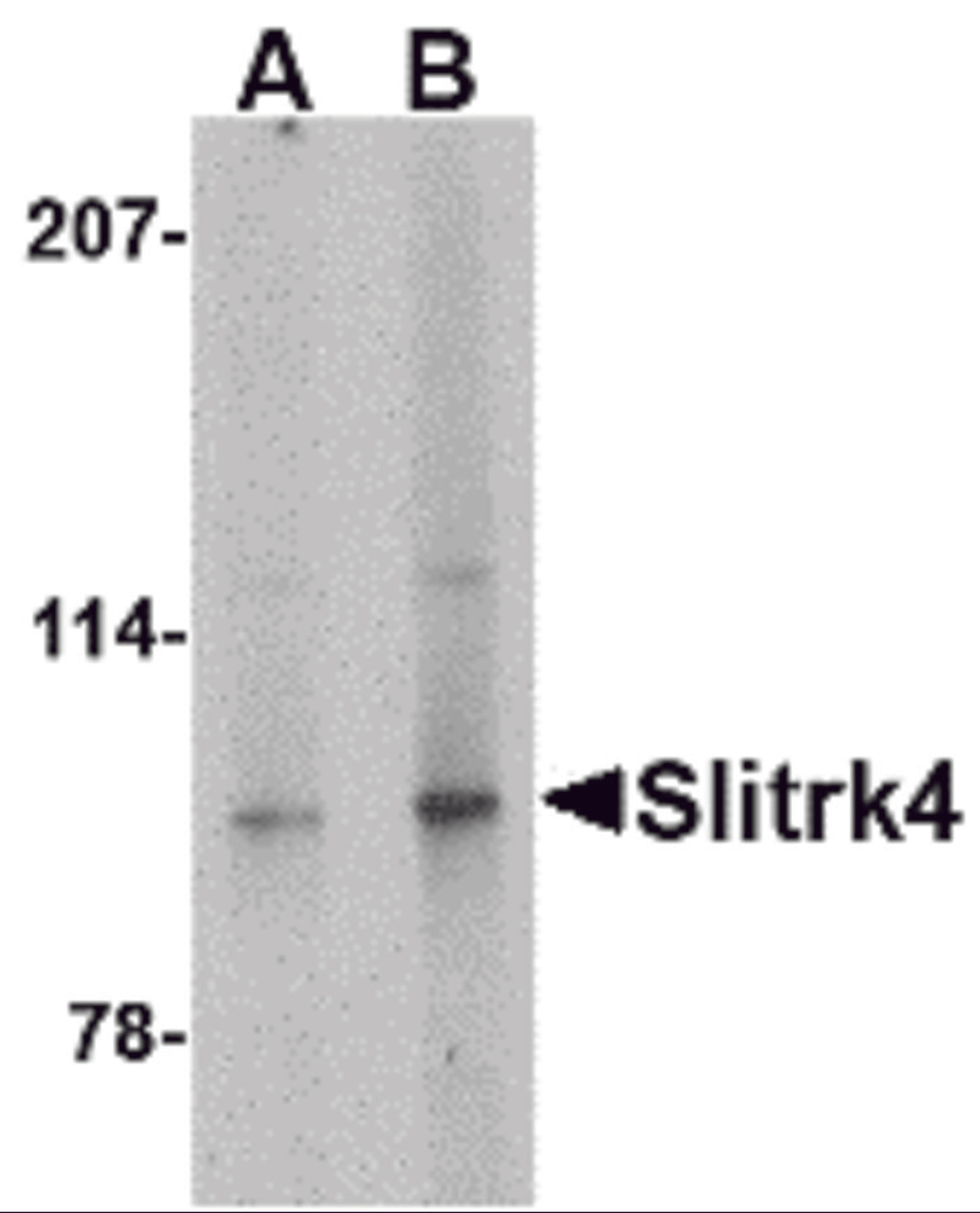 Western blot analysis of Slitrk4 in mouse brain tissue lysate with Slitrk4 antibody at (A) 0.5 and (B) 1 &#956;g/mL.