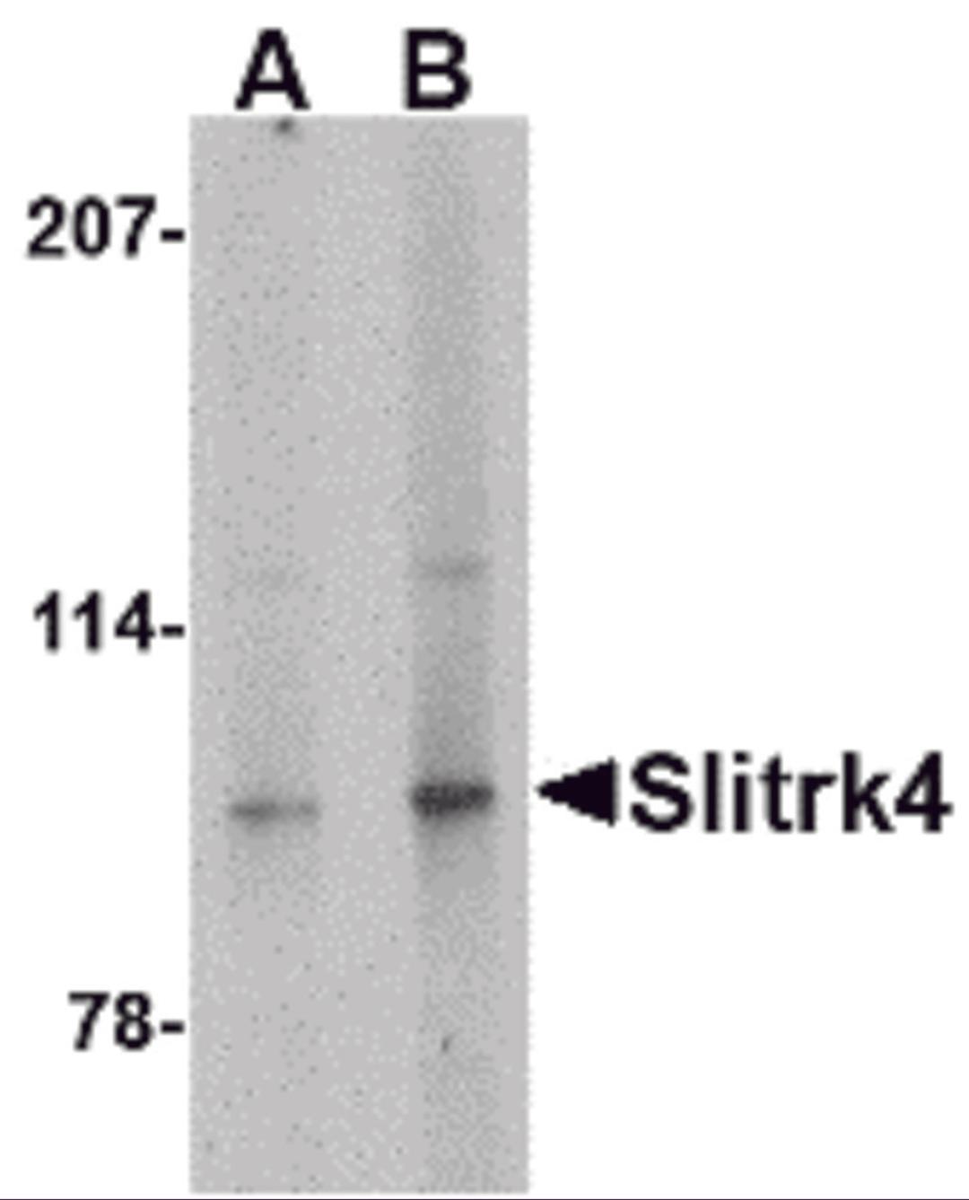 Western blot analysis of Slitrk4 in mouse brain tissue lysate with Slitrk4 antibody at (A) 0.5 and (B) 1 μg/mL.