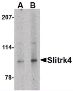 Western blot analysis of Slitrk4 in mouse brain tissue lysate with Slitrk4 antibody at (A) 0.5 and (B) 1 μg/mL.