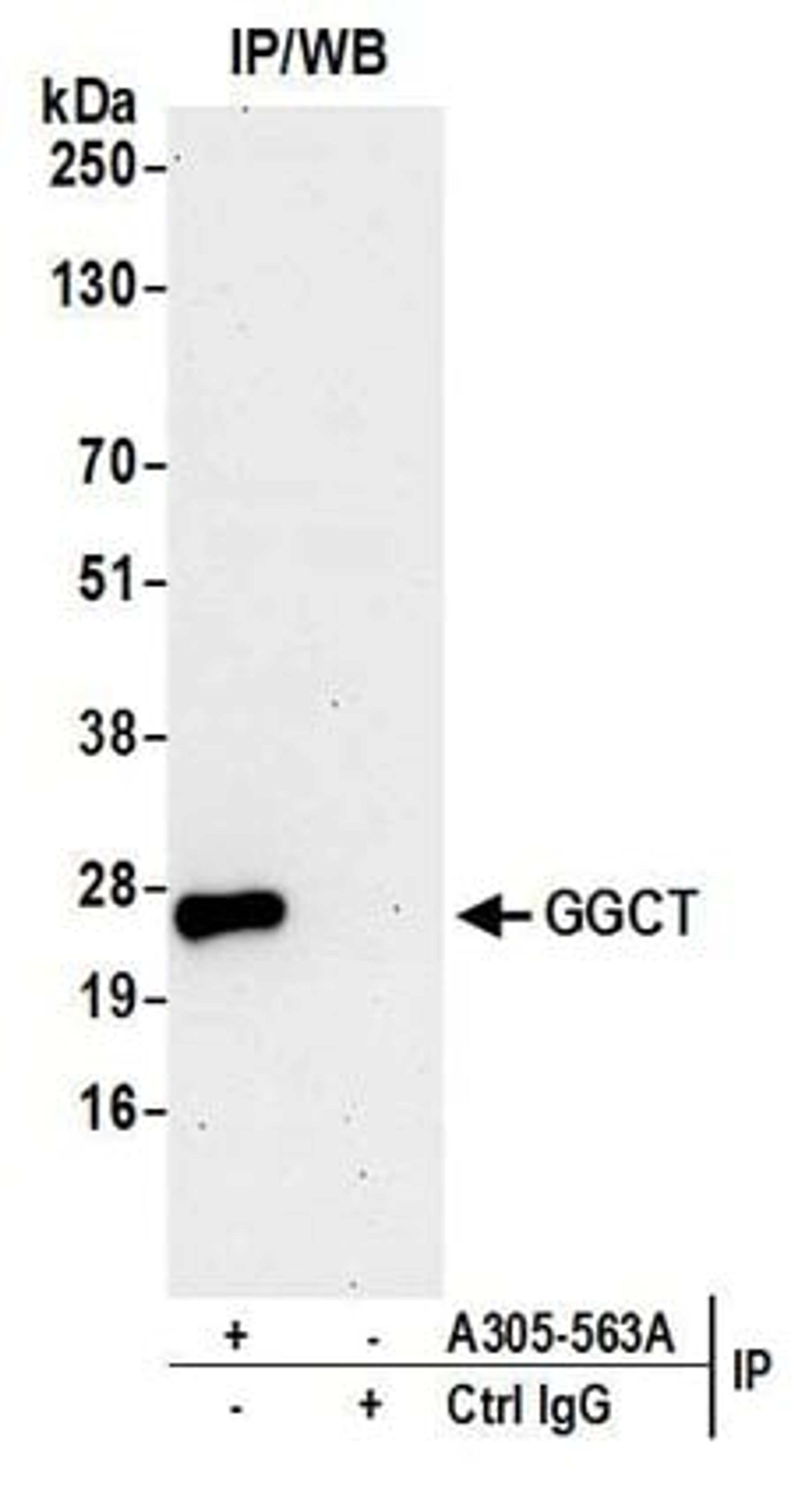 Detection of human GGCT by western blot of immunoprecipitates.