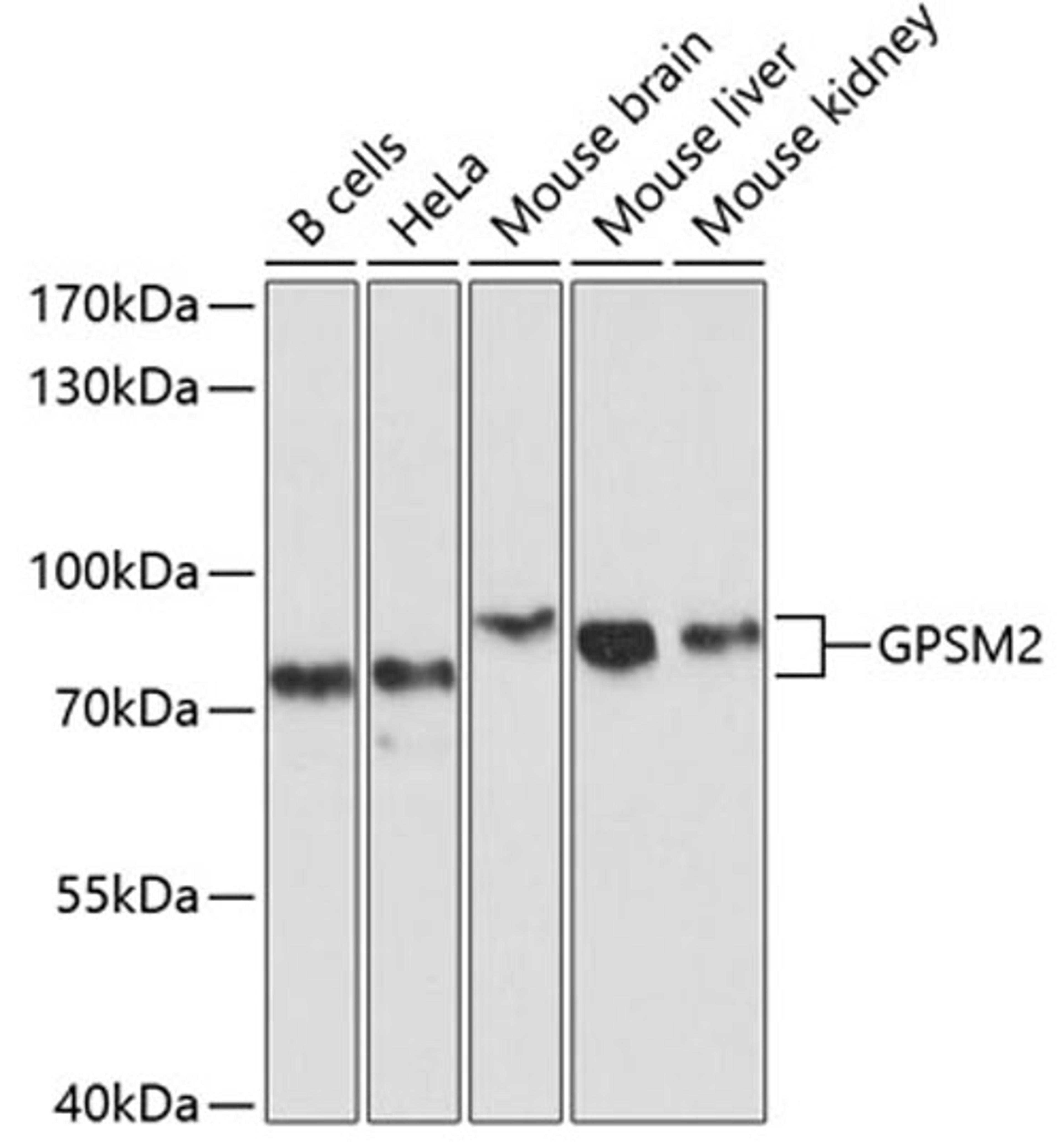 Western blot - GPSM2 antibody (A10553)