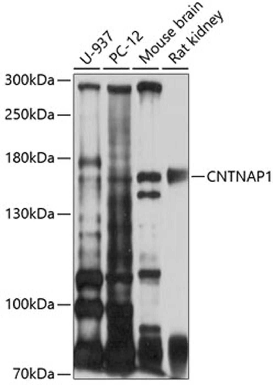 Western blot - CNTNAP1 antibody (A10058)