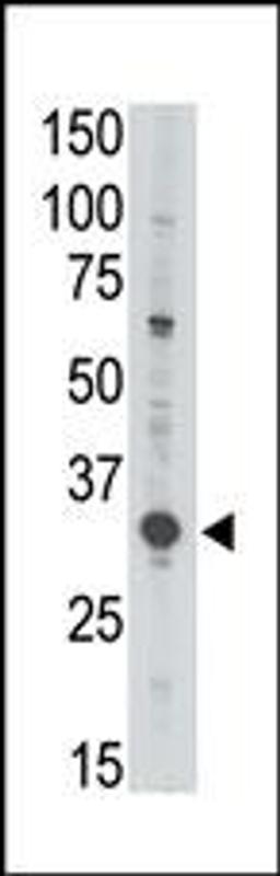 Antibody is used in Western blot to detect MAGEA3 in Jurkat lysate.