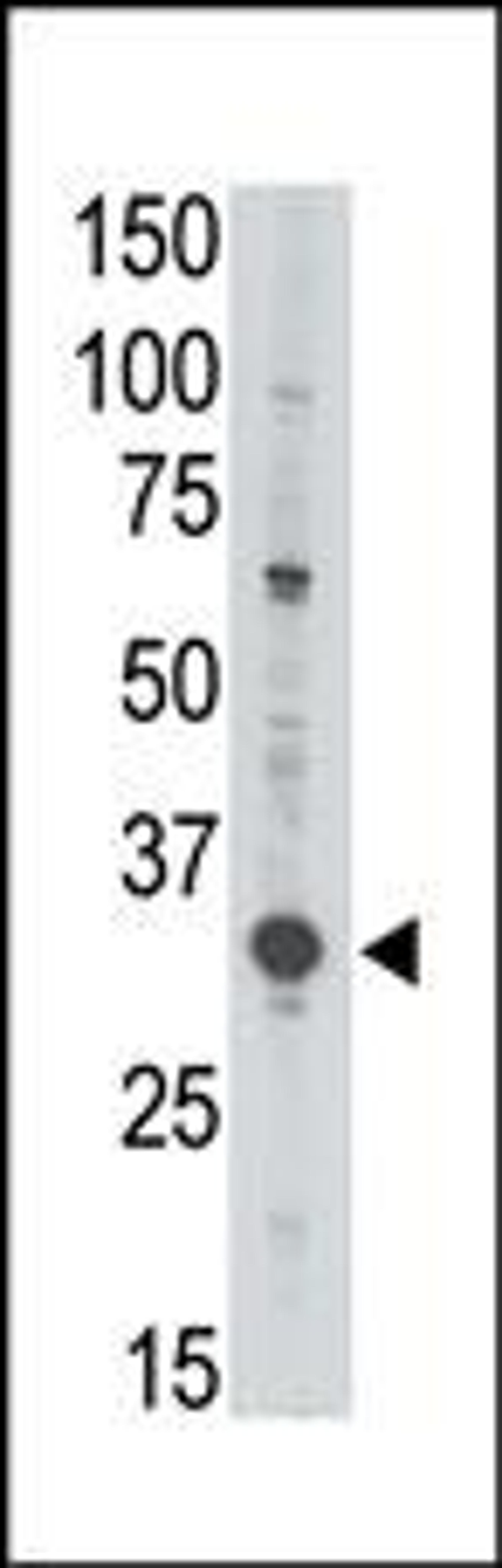 Antibody is used in Western blot to detect MAGEA3 in Jurkat lysate.