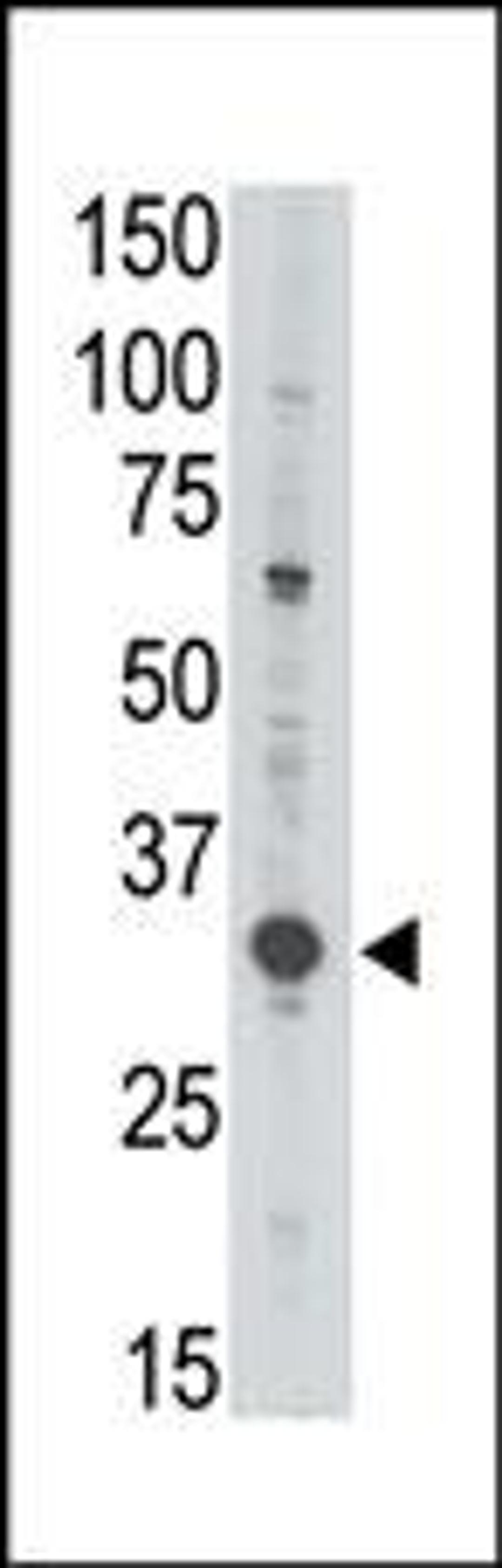 Antibody is used in Western blot to detect MAGEA3 in Jurkat lysate.