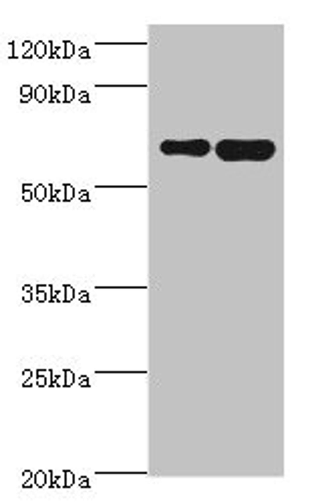 Western blot. All lanes: STXBP3 antibody at 10ug/ml. Lane 1: HepG2 whole cell lysate. Lane 2: K562 whole cell lysate. Secondary. Goat polyclonal to rabbit IgG at 1/10000 dilution. Predicted band size: 68 kDa. Observed band size: 68 kDa.